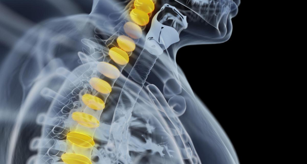 FAQ: ¿puedo hacer ejercicio si tengo una hernia?